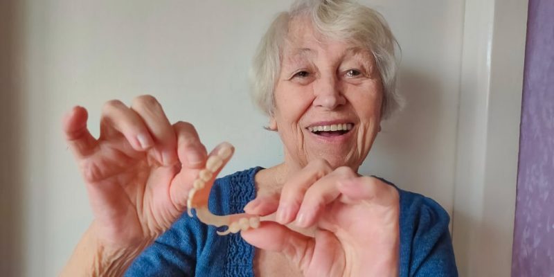 The Pros & Cons Of Removable Partial Dentures