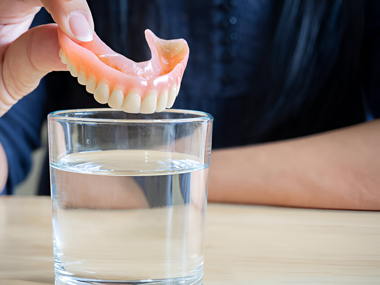 The Process of Getting Dentures: What to Expect_3