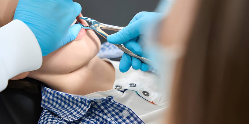 How Caring Modern Dentistry Makes Tooth Extractions Comfortable and Stress-Free_FI